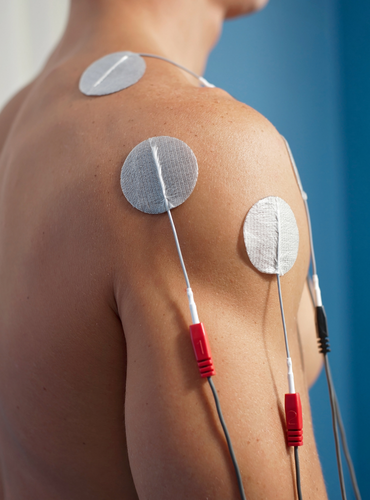 electrical stimulation electrotherapy